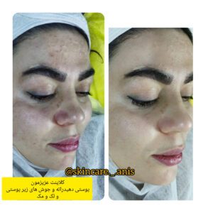 انیس پوررضائی