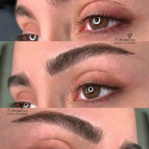 میکروبلیدینگ غرب تهران ندا طاهری